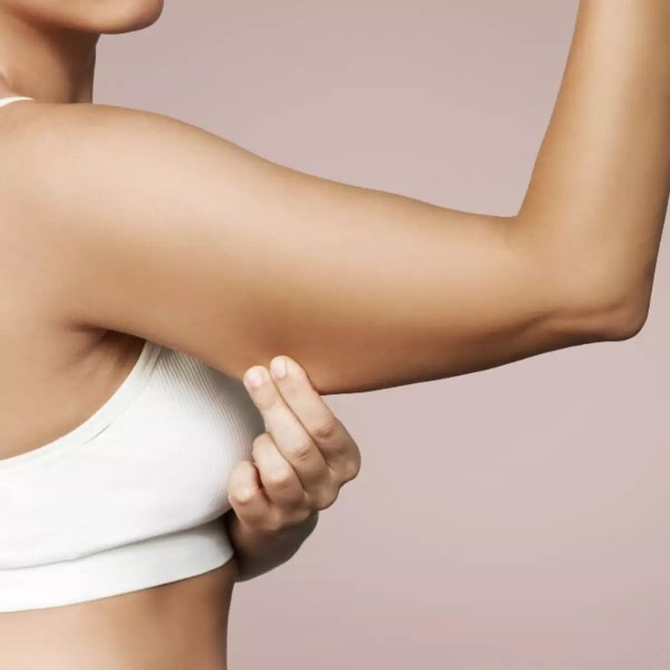 Arm Lift